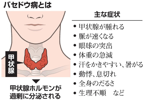 中山美穂は持病や病気を患っていた？