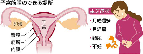 中山美穂は持病や病気を患っていた？